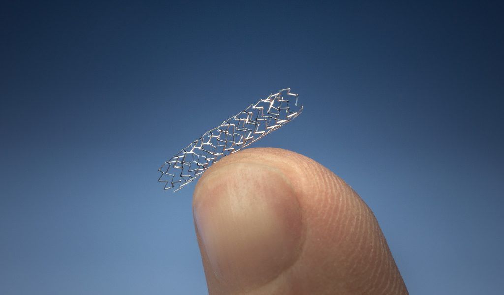 Herzstents (Stent)