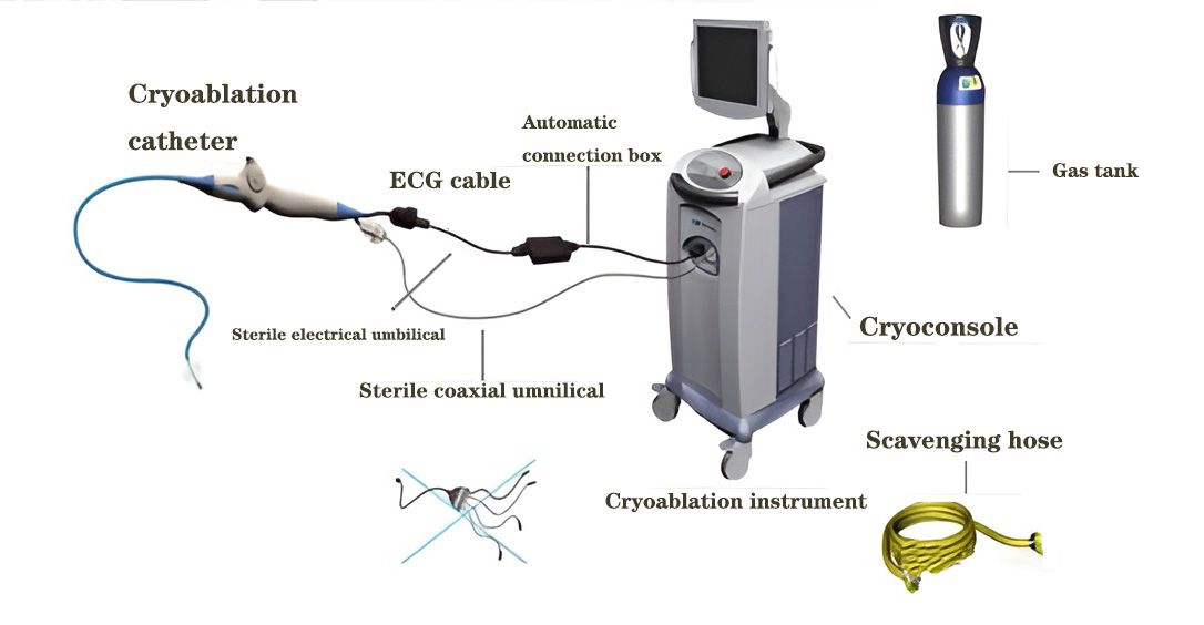 Grundkomponenten eines Kryoablation-Systems