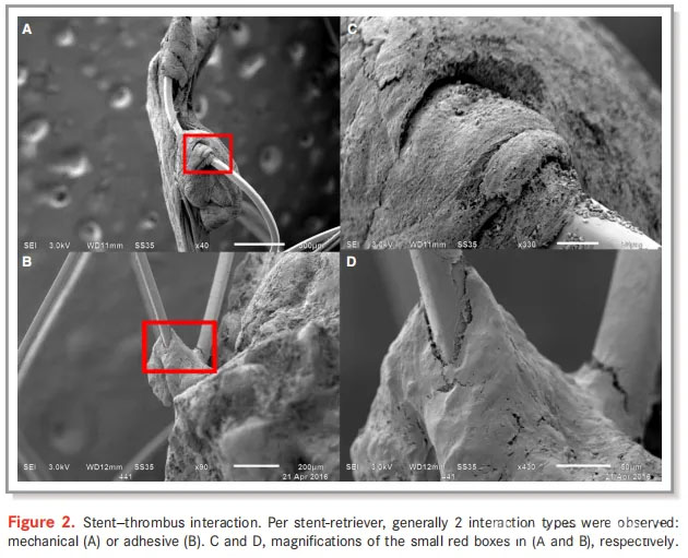 Stent-Thrombus-Wechselwirkung