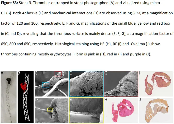 Thrombektomie-Stents